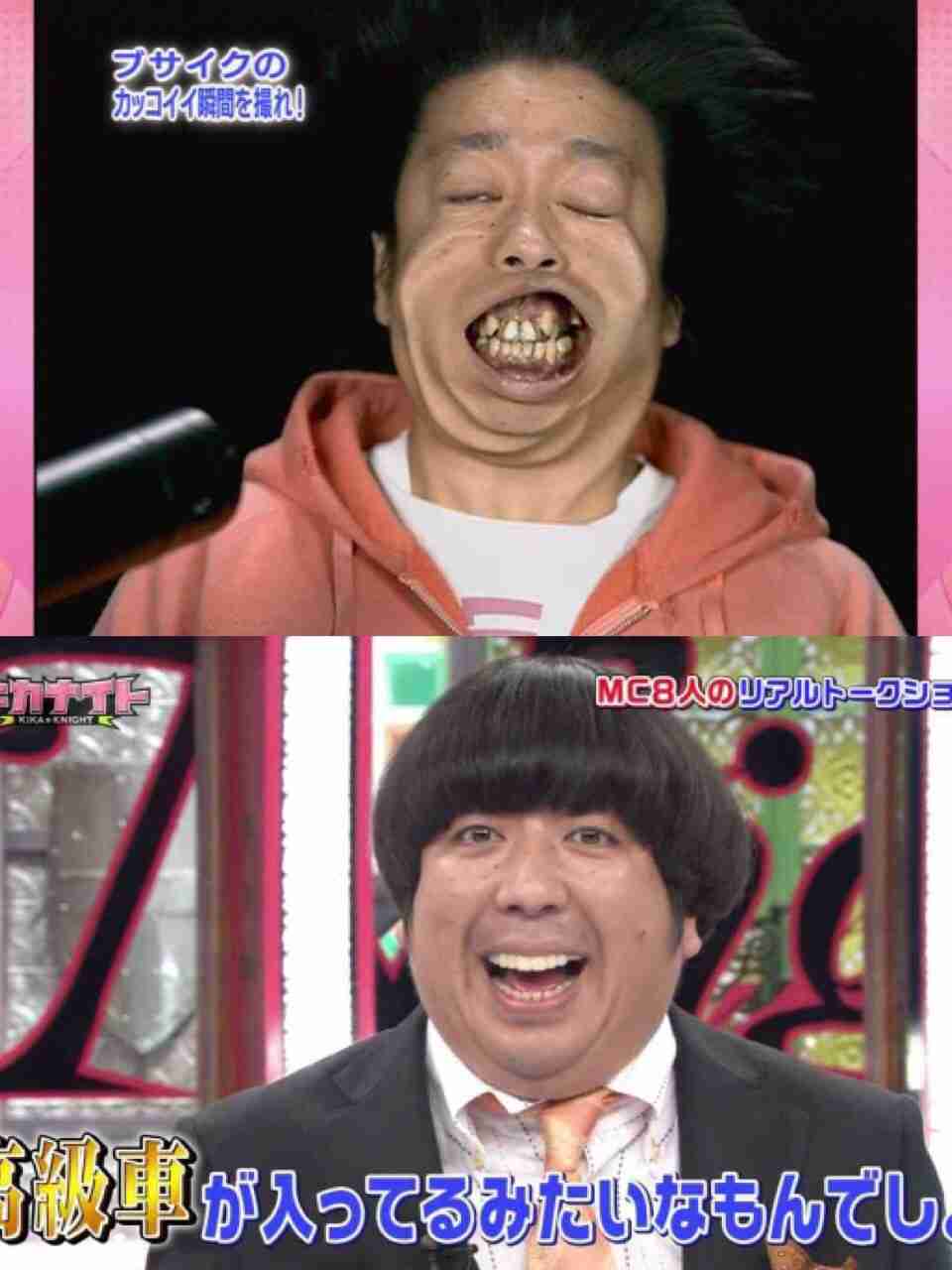 口元をいじったせいで残念になった芸能人は？