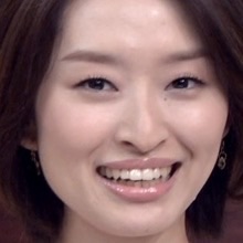 口元をいじったせいで残念になった芸能人は？
