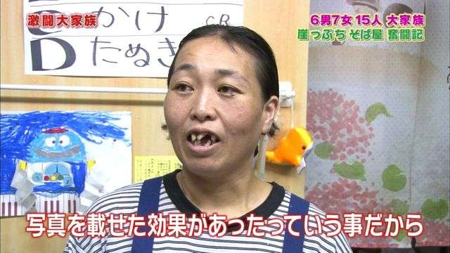 口元をいじったせいで残念になった芸能人は？