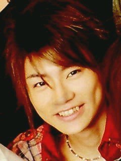 口元をいじったせいで残念になった芸能人は？