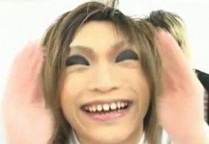 口元をいじったせいで残念になった芸能人は？