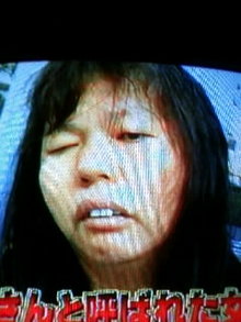 左右の目の大きさ、形が違う方