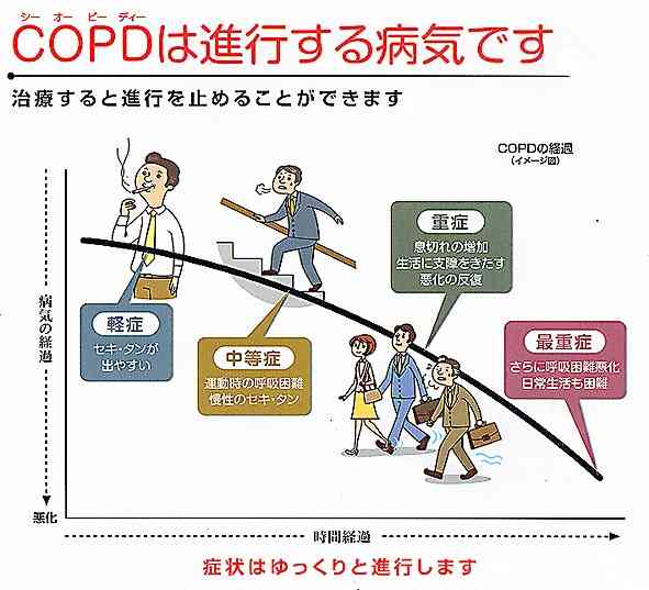 【喫煙者限定トピ】タバコあるある