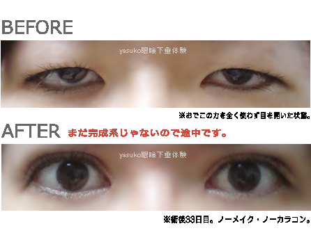 整形した人集合