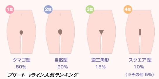 下の毛ってお手入れしてますか？