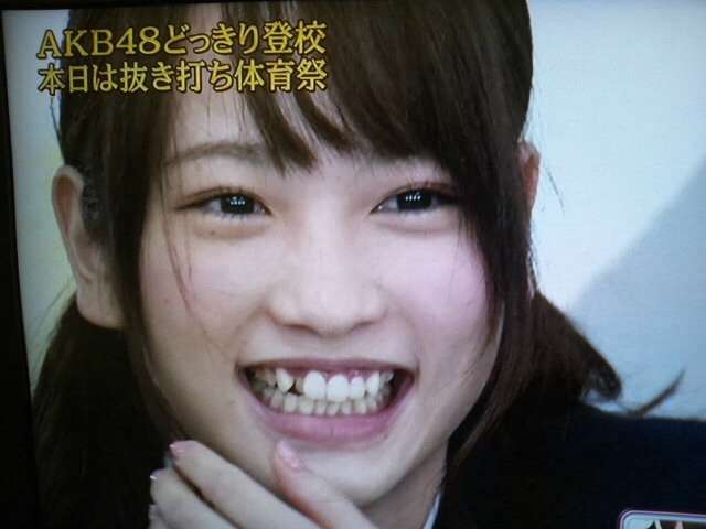 AKB48川栄李奈の首にキスマークか、本人否定も美保純「6秒くらいでああなる」