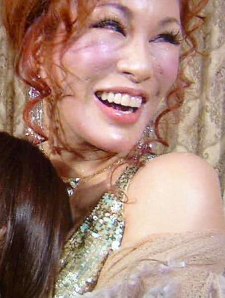 「スッキリ!!」に出演した平子理沙さんの顔が変わったとネットで話題に。