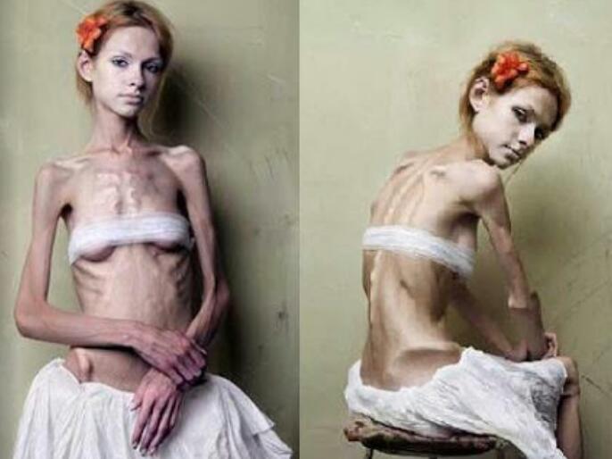 罰金や投獄も フランスで 痩せすぎ スーパーモデルの刑罰制定へ ガールズちゃんねる Girls Channel