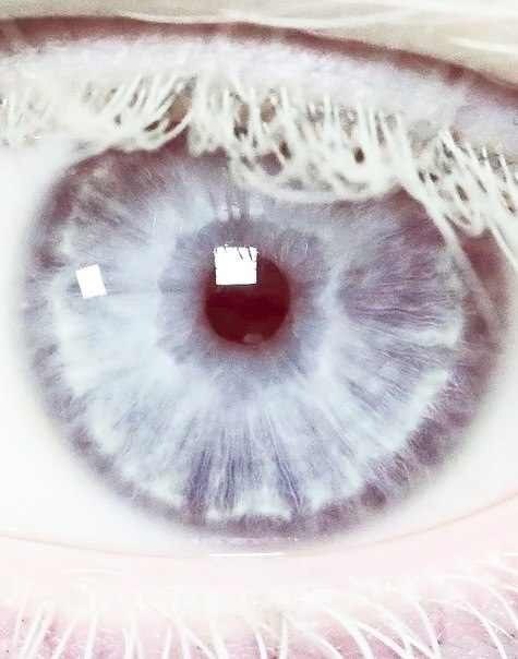 レーザーによりブルーの瞳を手に入れる!?米国でもすでに実験段階。