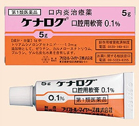 口内炎の治し方