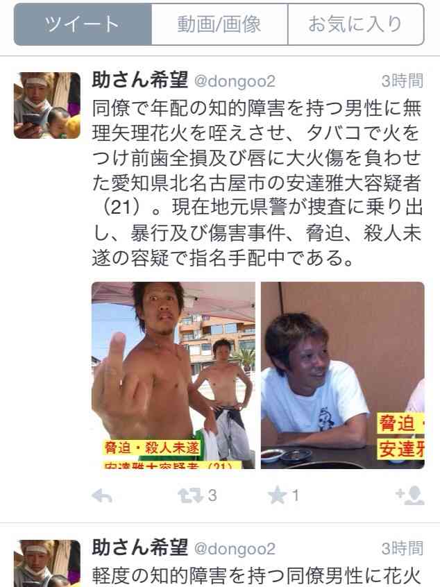 【閲覧注意】若者が老人に花火をくわえさせ、口の中を大ケガさせた動画が投稿される