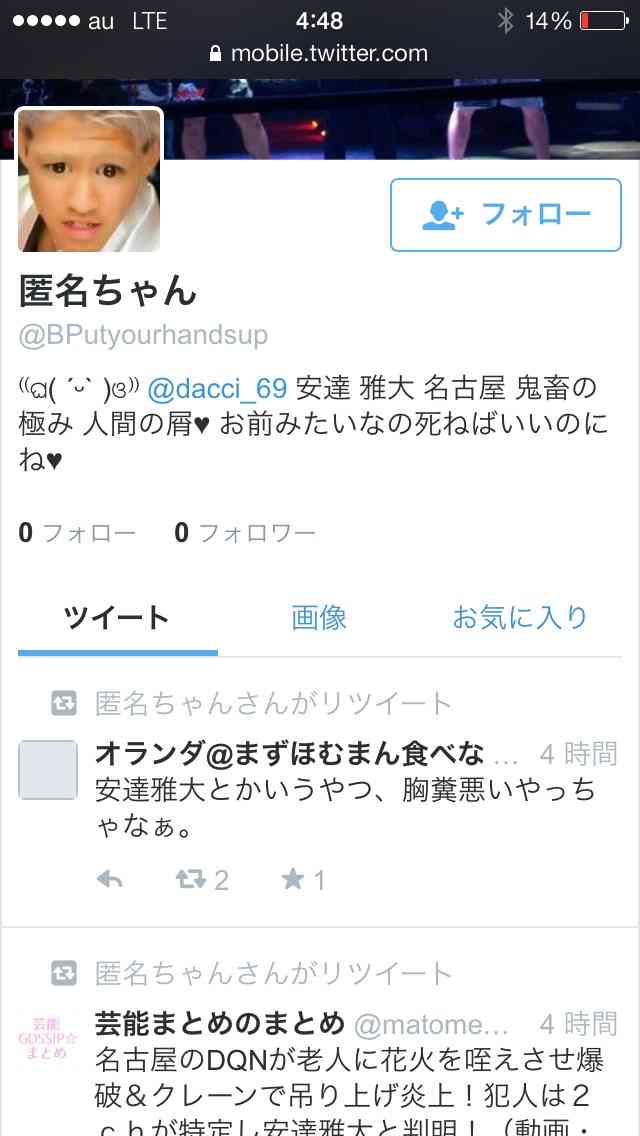 【閲覧注意】若者が老人に花火をくわえさせ、口の中を大ケガさせた動画が投稿される