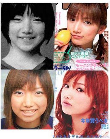 成長・加齢により顔の形が変わった人！