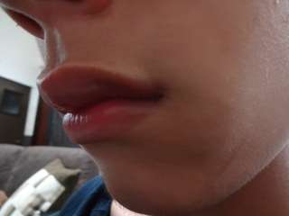 全身脱毛について