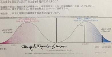 出生前診断受けた方、受けてみてどうでしたか？