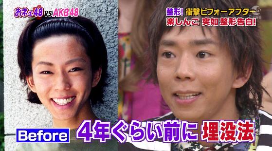 整形し過ぎたと思う有名人