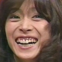 整形し過ぎたと思う有名人