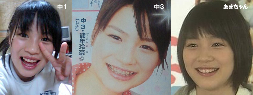 整形し過ぎたと思う有名人