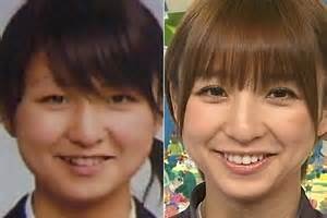 整形し過ぎたと思う有名人