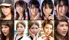 整形し過ぎたと思う有名人