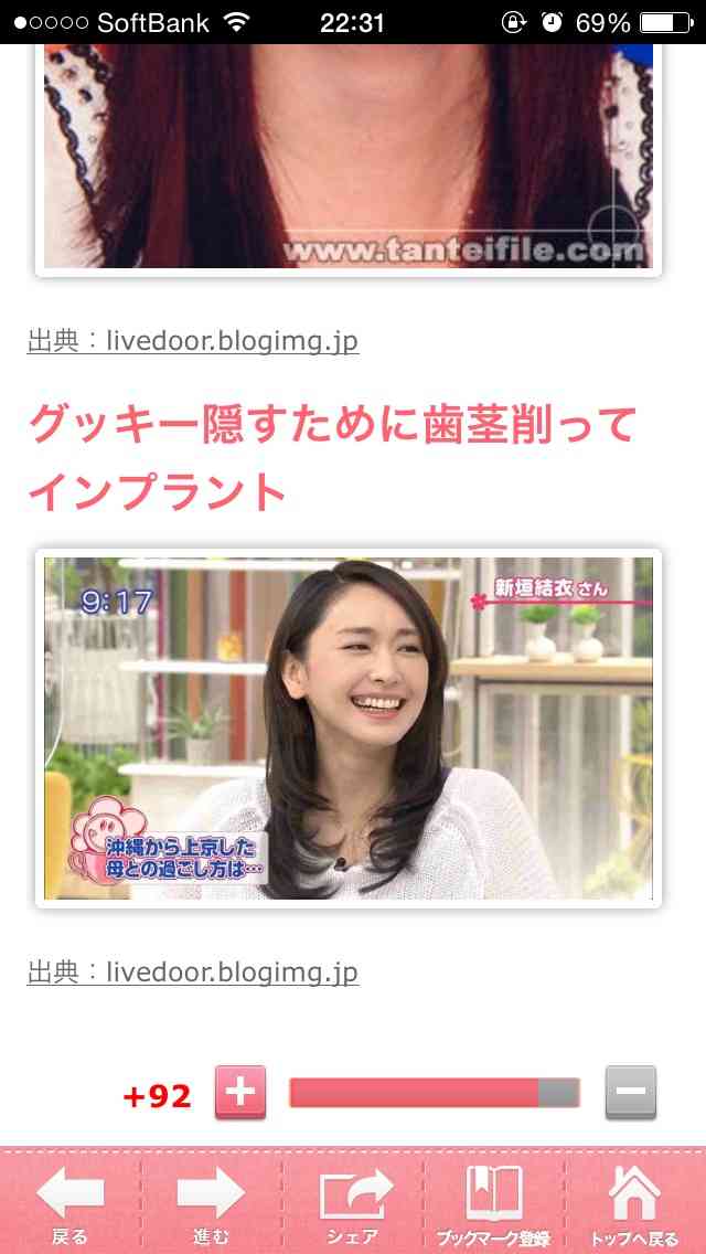 整形し過ぎたと思う有名人