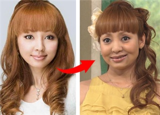 整形し過ぎたと思う有名人