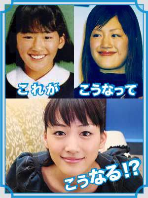 整形し過ぎたと思う有名人