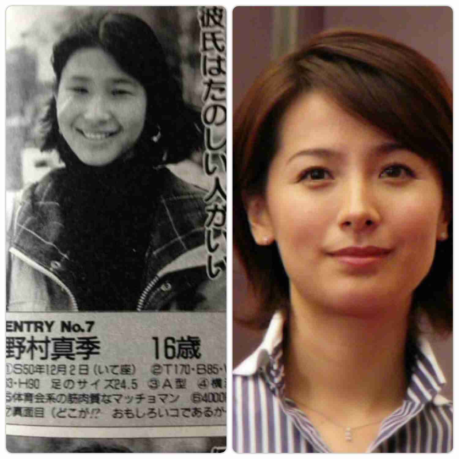 整形し過ぎたと思う有名人