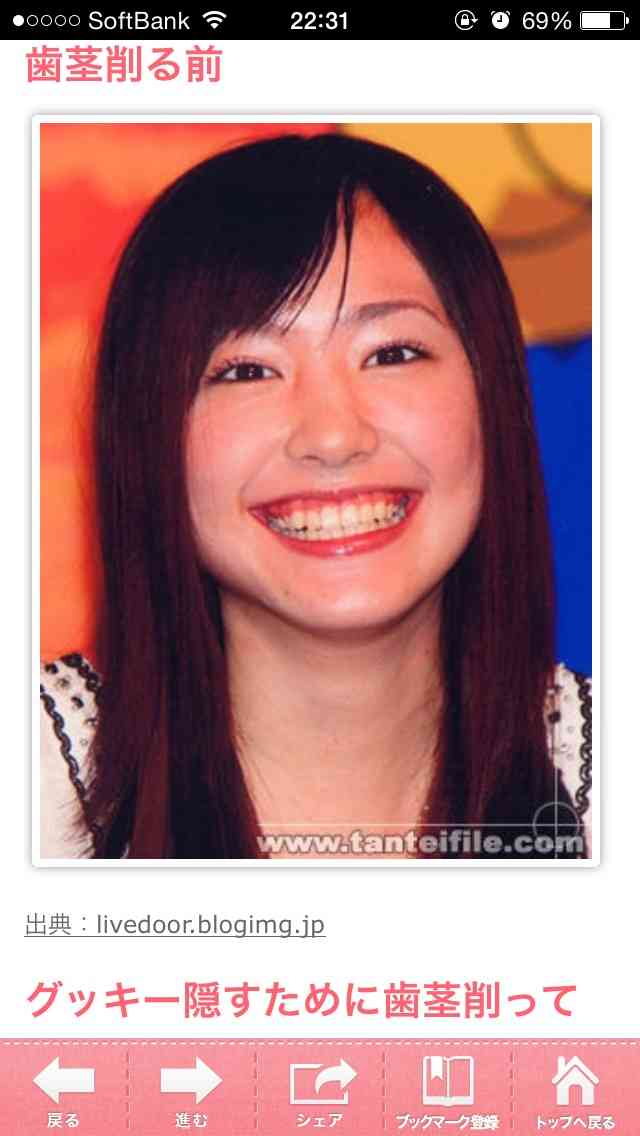 整形し過ぎたと思う有名人