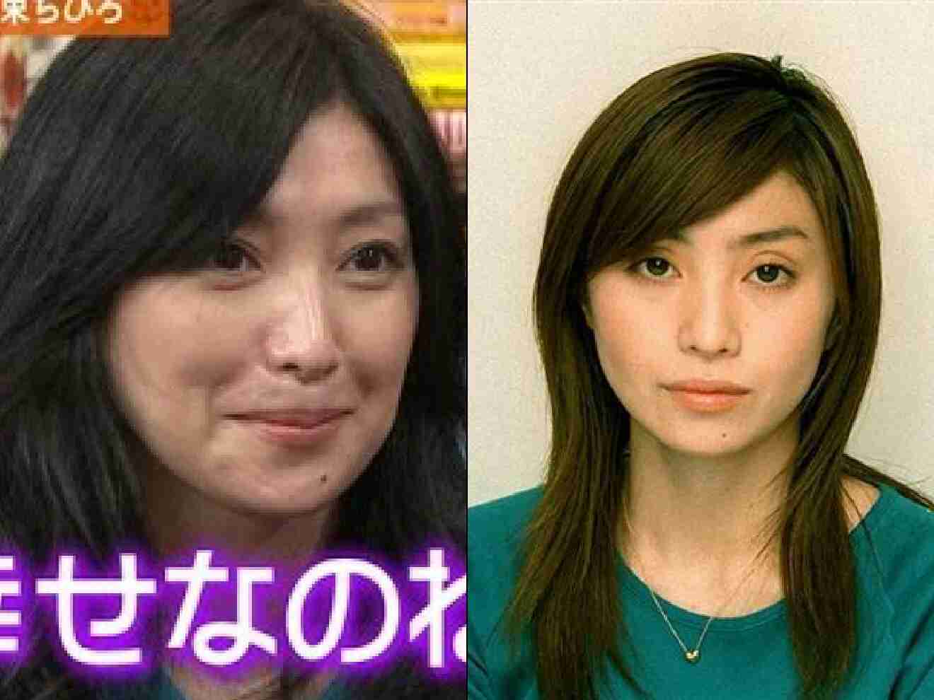 整形し過ぎたと思う有名人