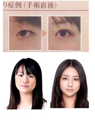 整形し過ぎたと思う有名人