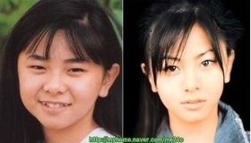整形し過ぎたと思う有名人