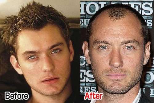 レオナルド・ディカプリオ、ヒゲを伸ばすのは生え際の後退をごまかすため？