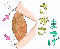 ゴールデンボンバー鬼龍院翔、逆さまつげの手術を決断