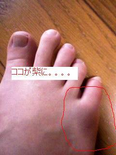 【閲覧注意】今まで1番痛かったこと