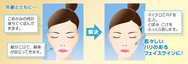 ほおがゲッソリこけた安藤美姫の姿に「大丈夫?」と心配の声