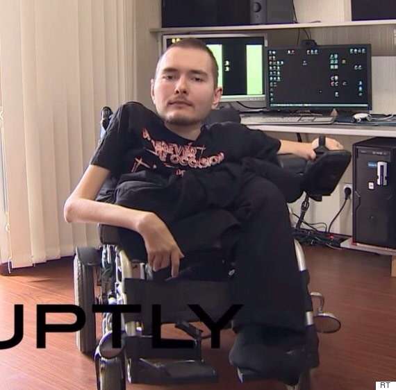 「頭を体から切り離し他人と結合」難病男性が手術へ