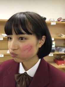 広瀬すず、ツイッターで幼少期の写真公開も騒動の影響引きずる形に