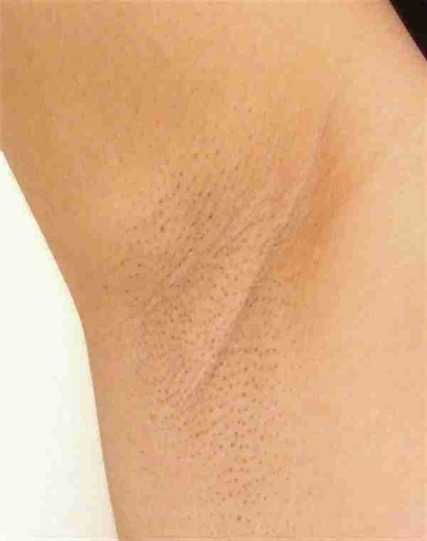 脇の下が汚ない人 居ませんか ガールズちゃんねる Girls Channel