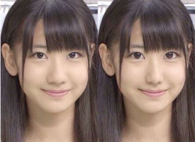 鼻プロテぽい芸能人