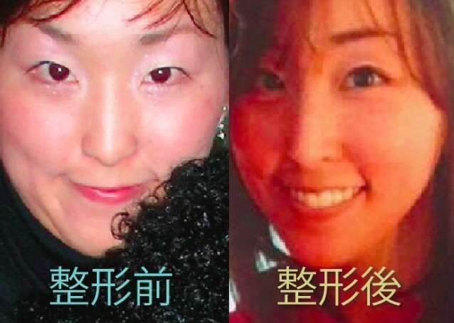 鼻プロテぽい芸能人