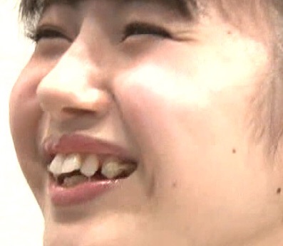 鼻プロテぽい芸能人