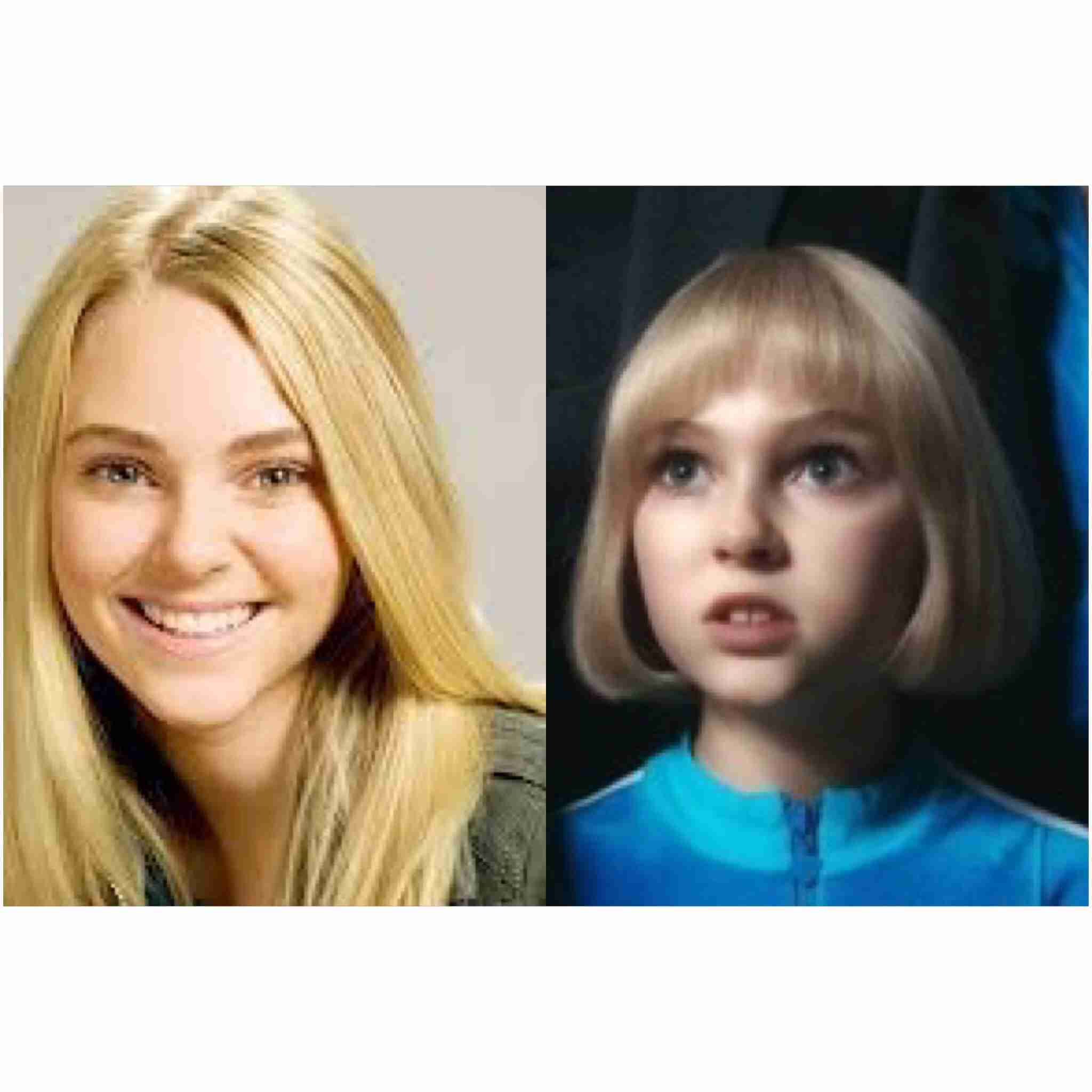 5年間ガムを噛み続けた女性 あごが開かず大規模手術へ こんな事になるなんて ガールズちゃんねる Girls Channel