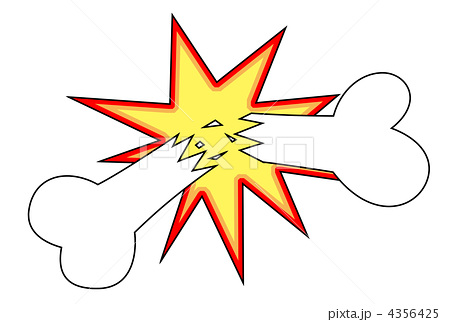 骨折したことある人集合！