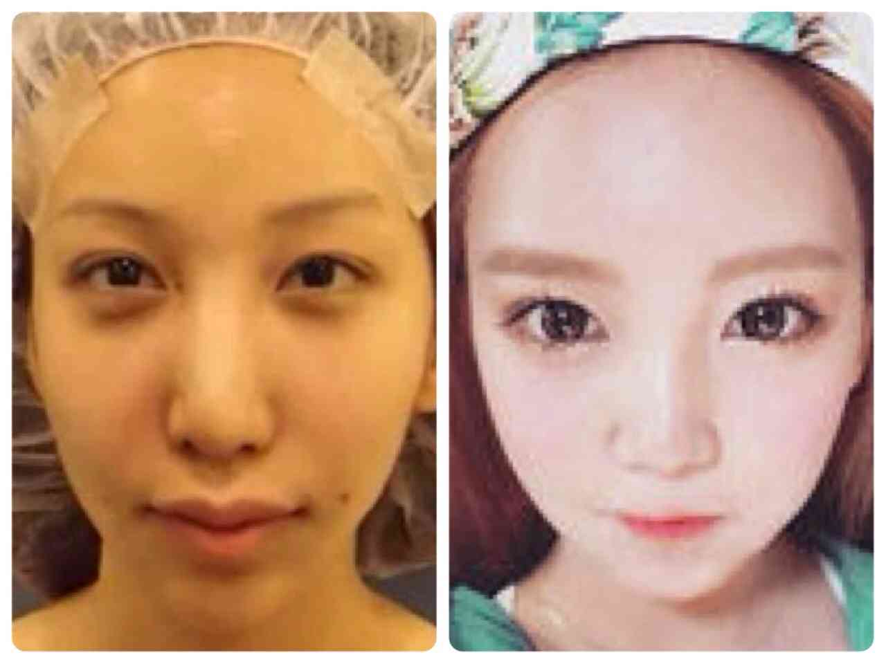 ざわちん、ブリーチ4回の明るすぎる髪色！「眩しくて見れない」の声