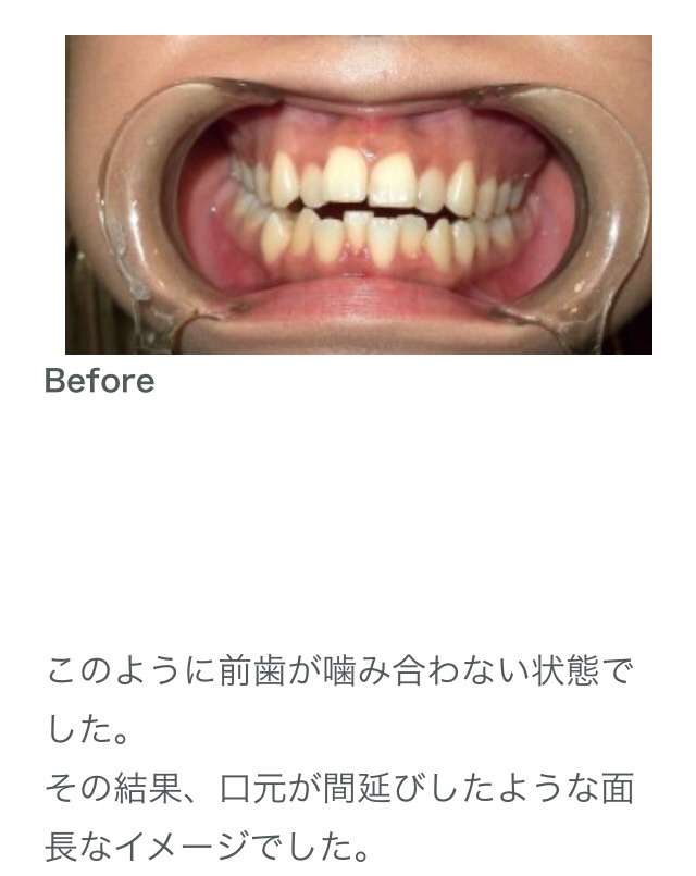 ざわちん、ブリーチ4回の明るすぎる髪色！「眩しくて見れない」の声