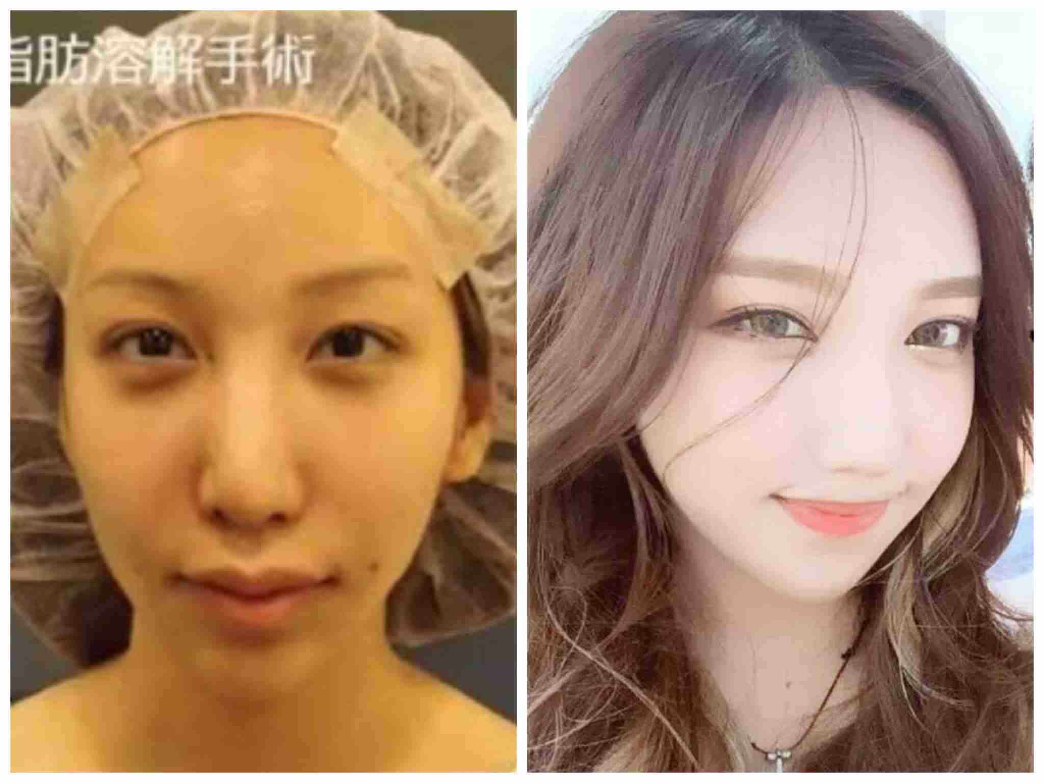 ざわちん、ブリーチ4回の明るすぎる髪色！「眩しくて見れない」の声