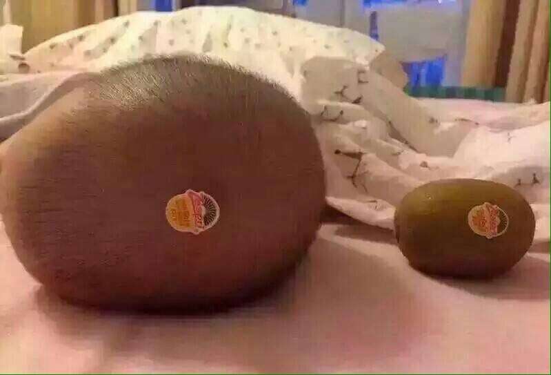 おもしろ画像をみんなで笑うトピ