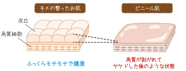 ビニール肌に心当たりのある方