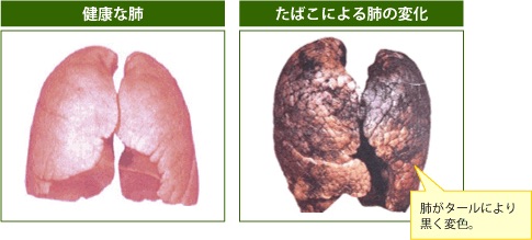 彼氏にタバコをやめてもらう方法!